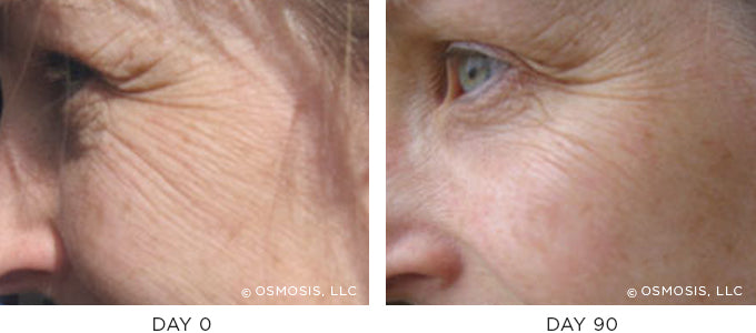 Before and After Aging Results